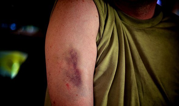 Intimate Partner Violence and Abuse 6